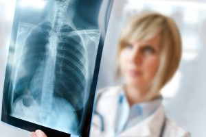 Female doctor examining an x-ray