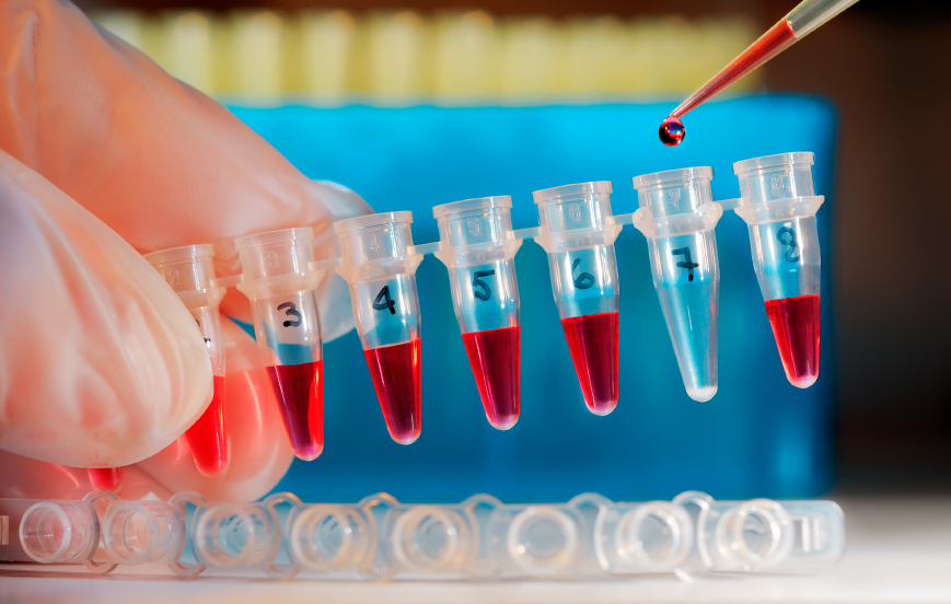 blood sample testing tubes