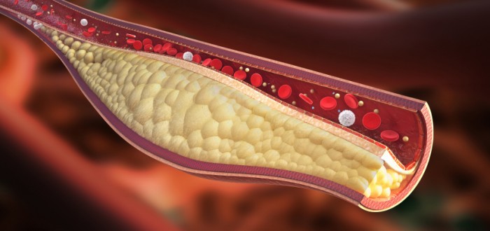 Cholesterol