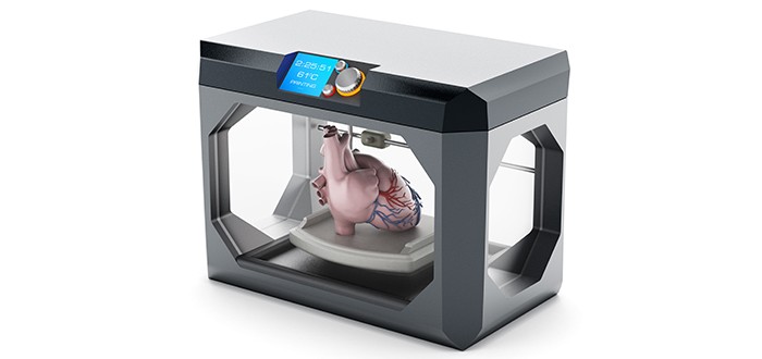 3-D Printing May Allow Replacement of Mesothelioma-Filled Tissue